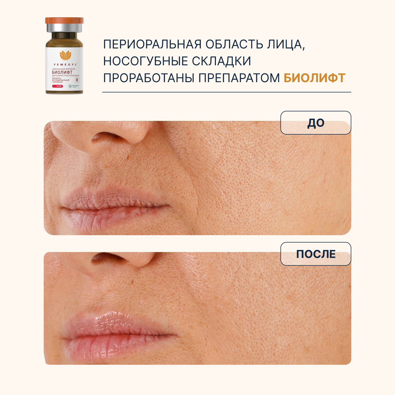 do-posle-4.jpg