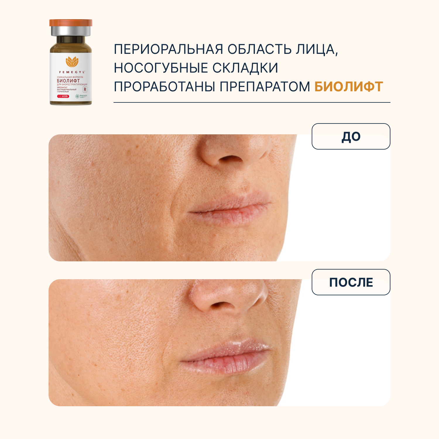 do-posle-6.jpg