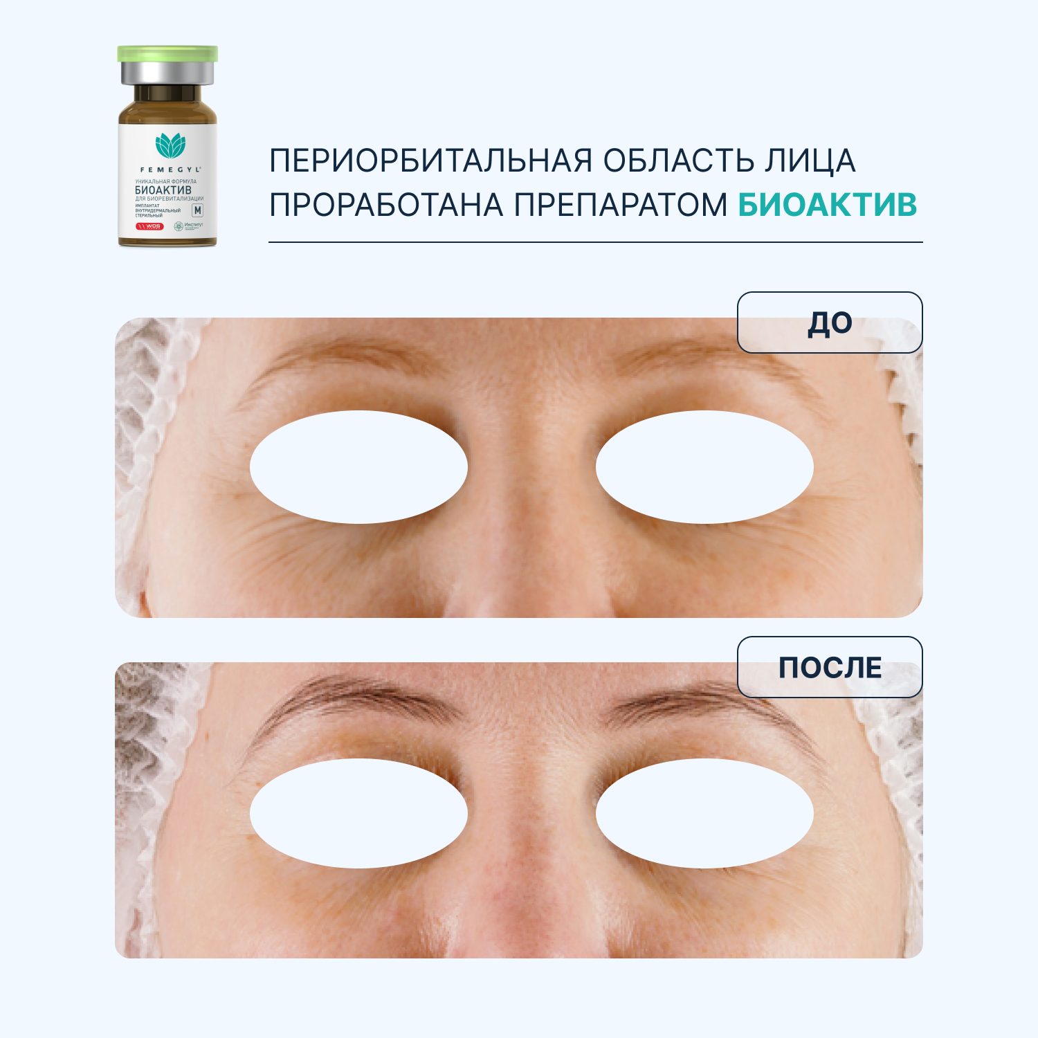 do-posle-2.jpg