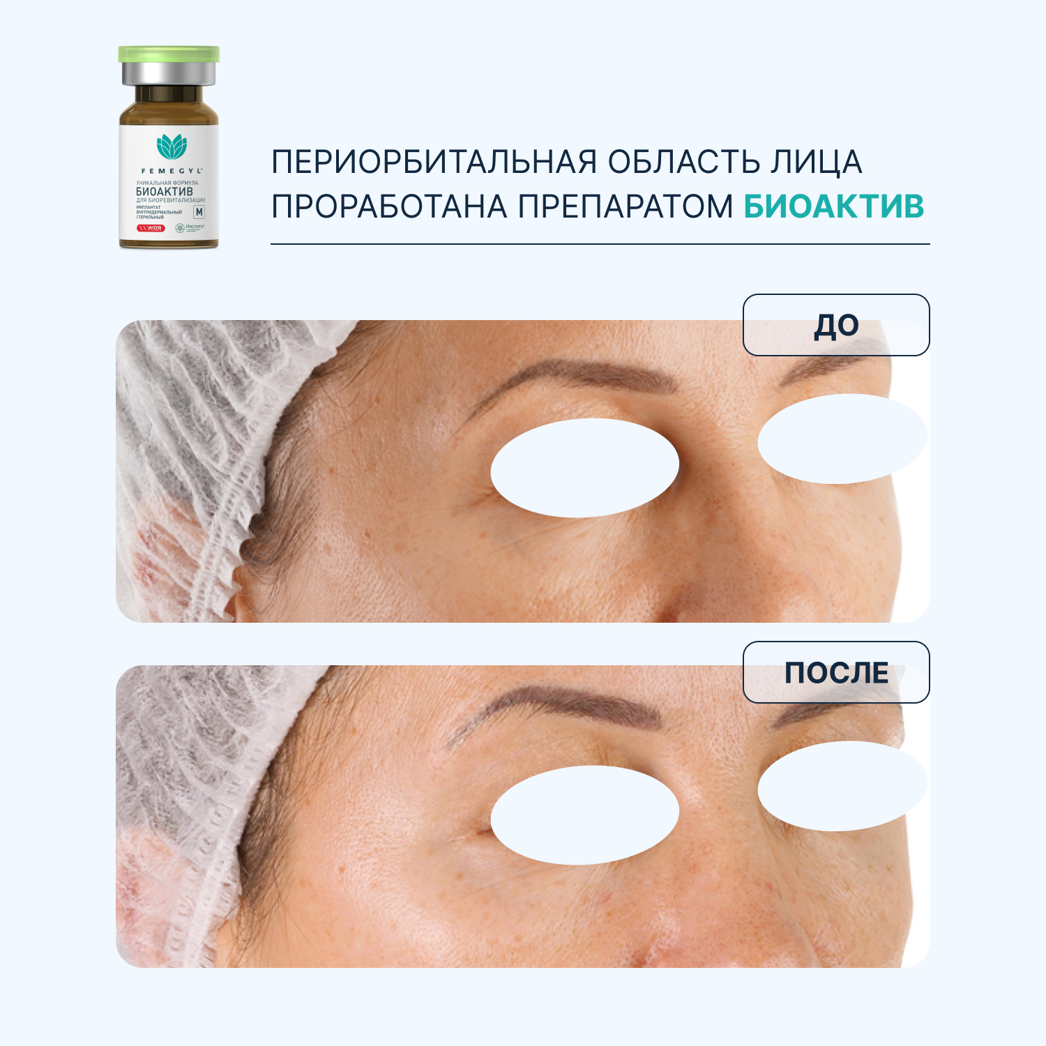 do-posle-5.jpg