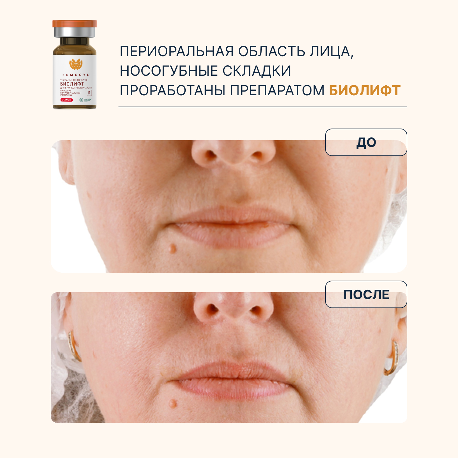 do-posle-3.jpg