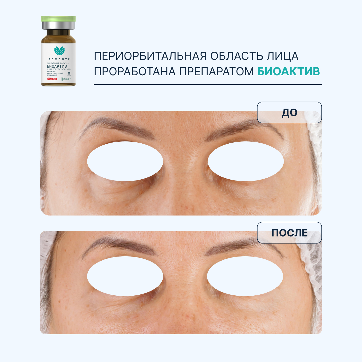 do-posle-1.jpg