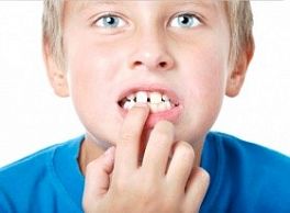 Почему темнеют зубы у ребенка