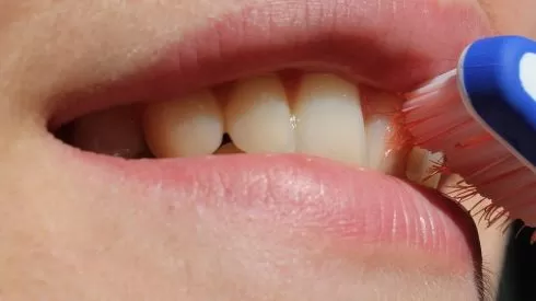 Кровоточность десен чистим зубы